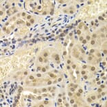 Immunohistochemistry - UMPS antibody from Signalway Antibody (38664) - Antibodies.com
