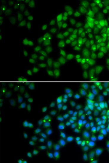 Immunofluorescence analysis of HeLa cell using EPC1 antibody. Blue: DAPI for nuclear staining.