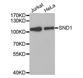 Western blot - SND1 antibody from Signalway Antibody (38700) - Antibodies.com