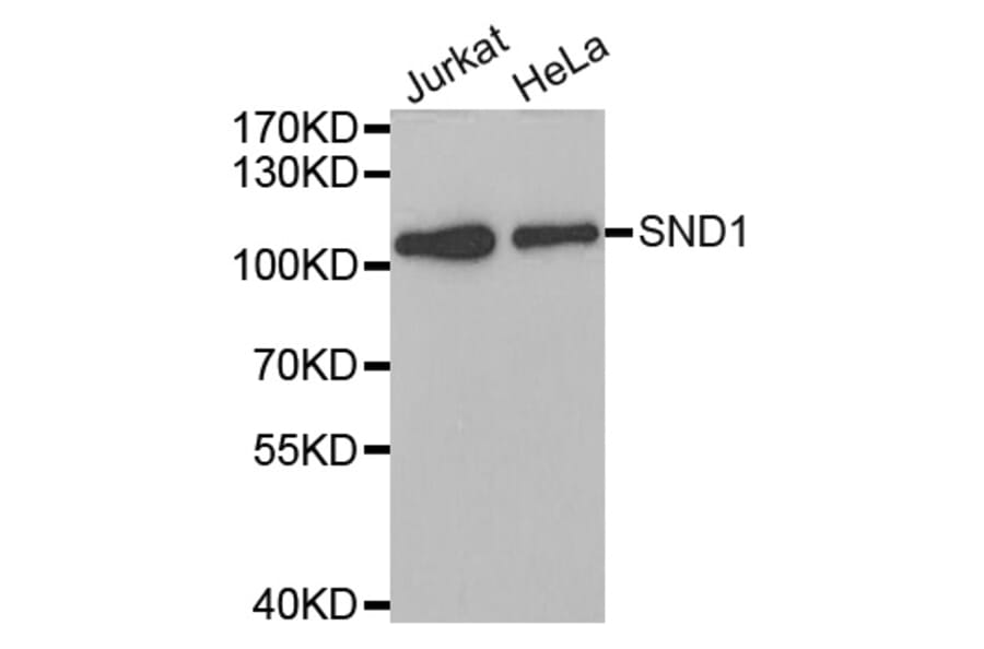 Western blot - SND1 antibody from Signalway Antibody (38700) - Antibodies.com