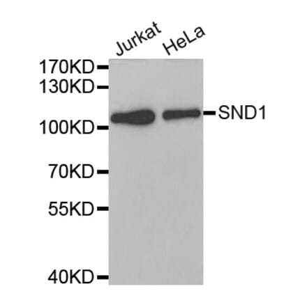 Western blot - SND1 antibody from Signalway Antibody (38700) - Antibodies.com