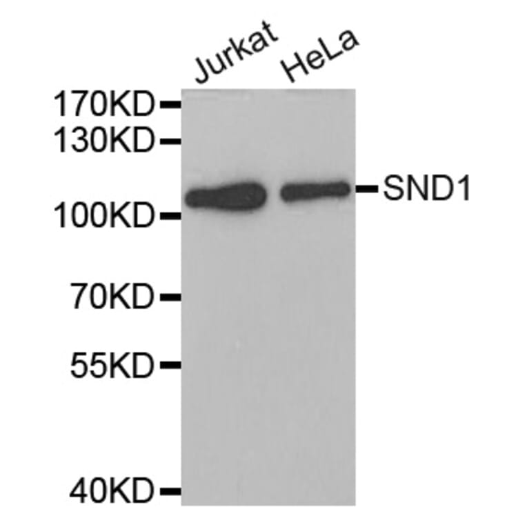 Western blot - SND1 antibody from Signalway Antibody (38700) - Antibodies.com