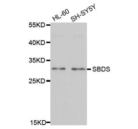 Western blot - SBDS antibody from Signalway Antibody (38702) - Antibodies.com