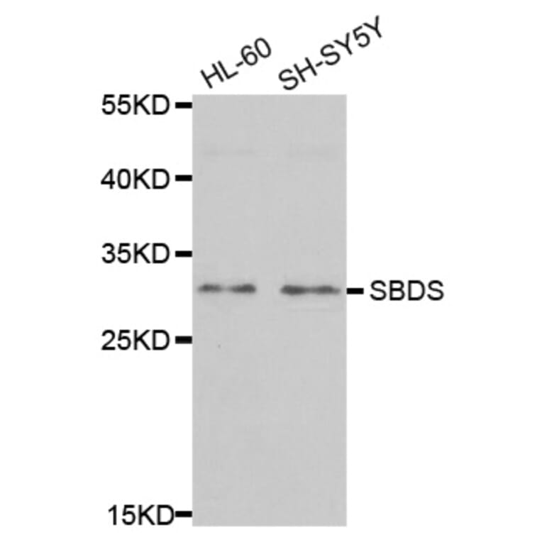 Western blot - SBDS antibody from Signalway Antibody (38702) - Antibodies.com