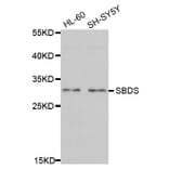 Western blot - SBDS antibody from Signalway Antibody (38702) - Antibodies.com