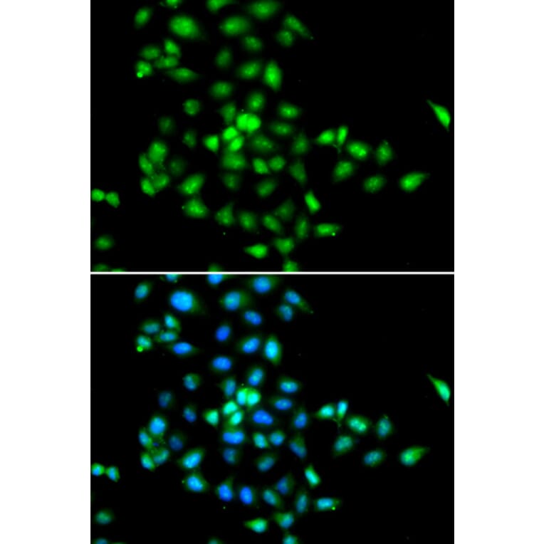 Immunofluorescence - SBDS antibody from Signalway Antibody (38702) - Antibodies.com