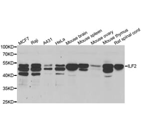 Western blot - ILF2 antibody from Signalway Antibody (38706) - Antibodies.com