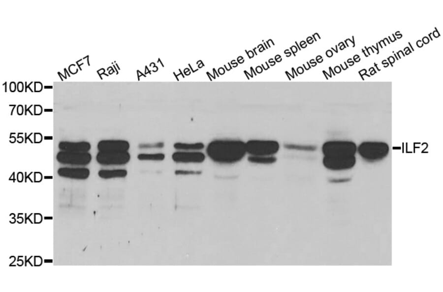 Western blot - ILF2 antibody from Signalway Antibody (38706) - Antibodies.com