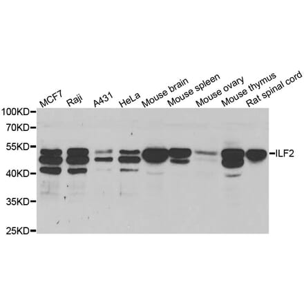 Western blot - ILF2 antibody from Signalway Antibody (38706) - Antibodies.com