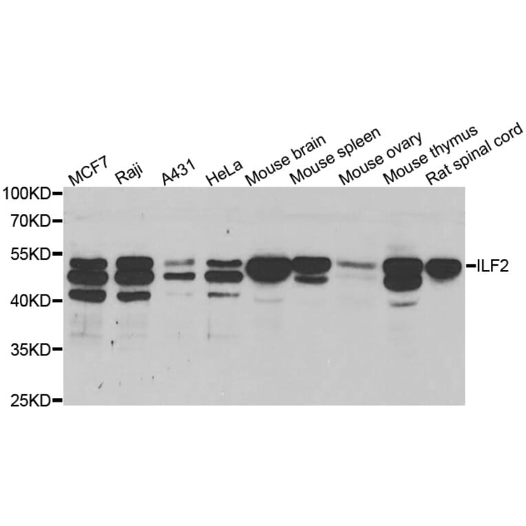 Western blot - ILF2 antibody from Signalway Antibody (38706) - Antibodies.com