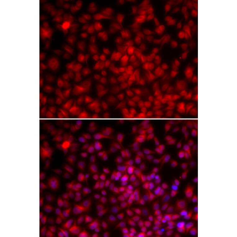 Immunofluorescence - ILF2 antibody from Signalway Antibody (38706) - Antibodies.com