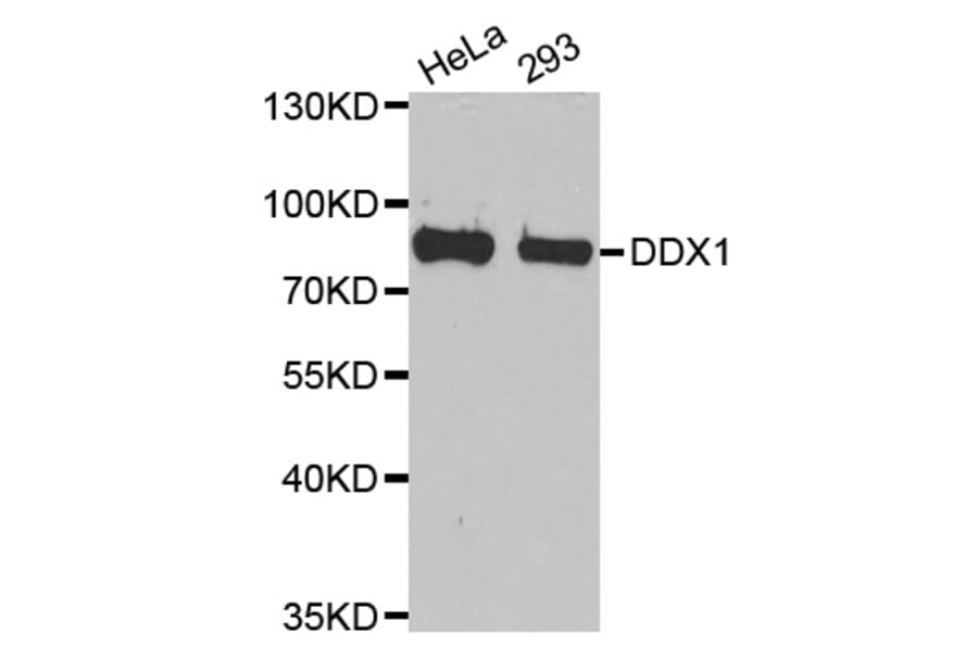 Western blot - DDX1 antibody from Signalway Antibody (38710) - Antibodies.com