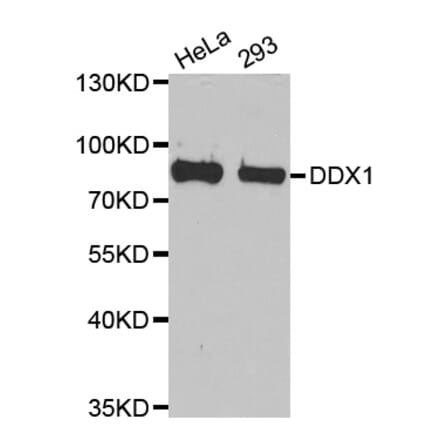 Western blot - DDX1 antibody from Signalway Antibody (38710) - Antibodies.com