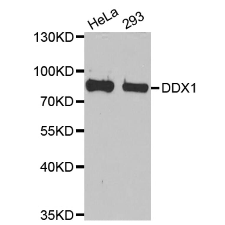 Western blot - DDX1 antibody from Signalway Antibody (38710) - Antibodies.com