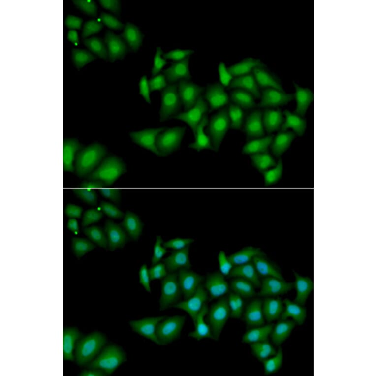 Immunofluorescence - DDX1 antibody from Signalway Antibody (38710) - Antibodies.com