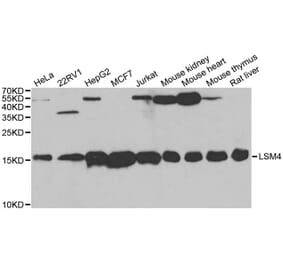 Western blot - LSM4 antibody from Signalway Antibody (38712) - Antibodies.com