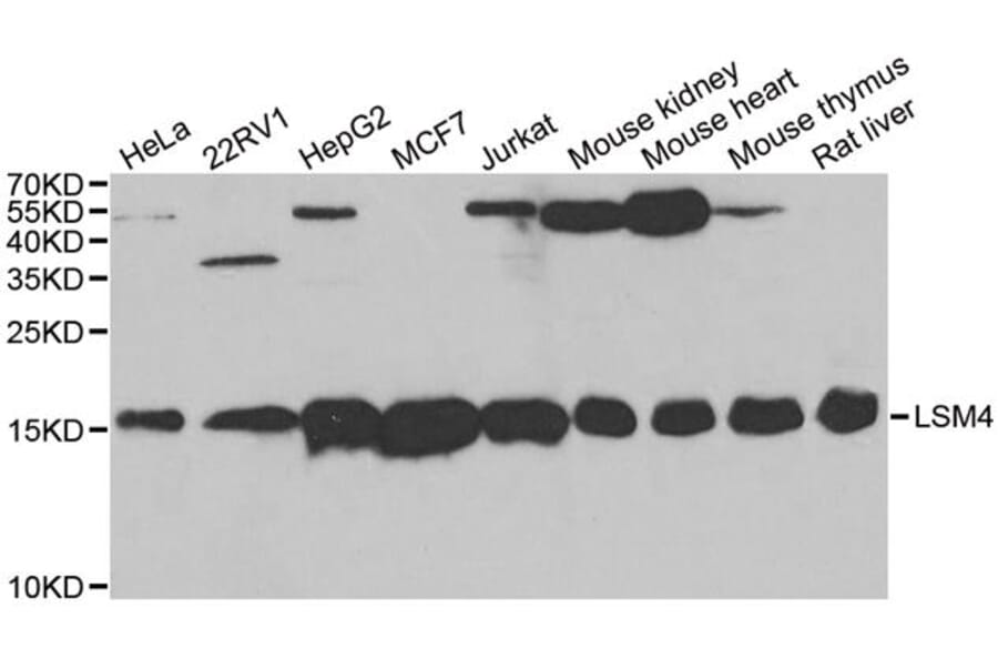 Western blot - LSM4 antibody from Signalway Antibody (38712) - Antibodies.com