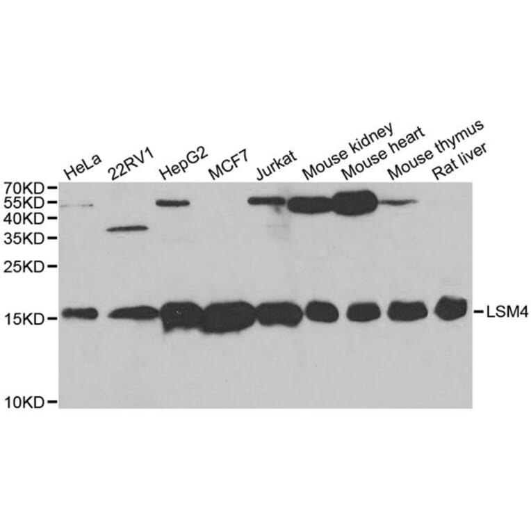 Western blot - LSM4 antibody from Signalway Antibody (38712) - Antibodies.com