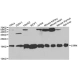 Western blot - LSM4 antibody from Signalway Antibody (38712) - Antibodies.com