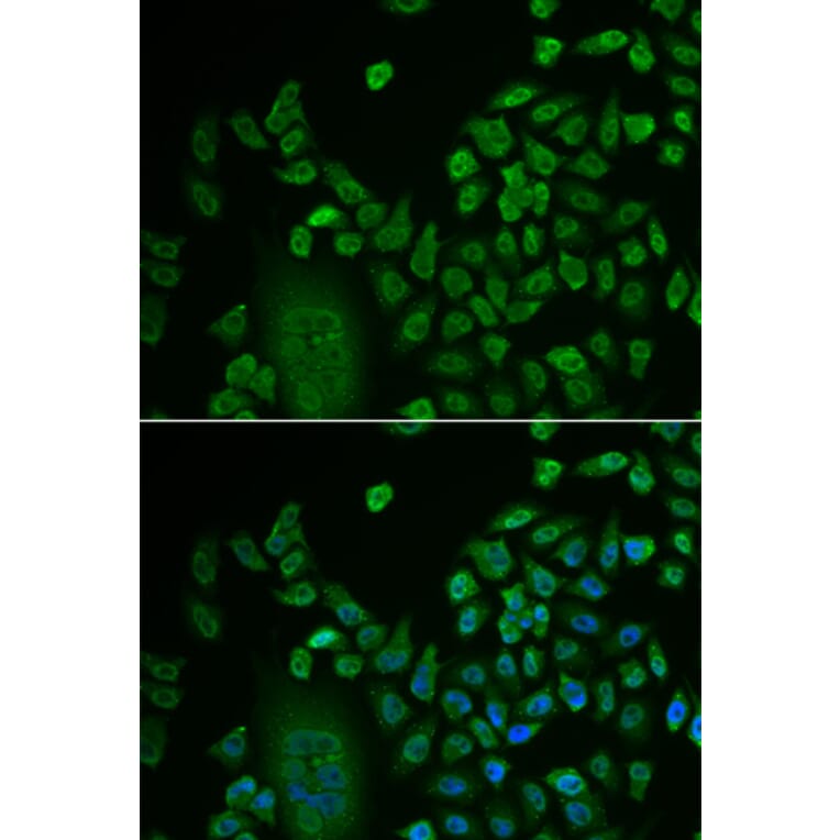 Immunofluorescence - LSM4 antibody from Signalway Antibody (38712) - Antibodies.com