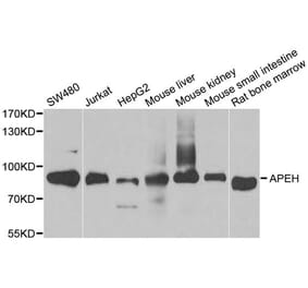 Western blot - APEH antibody from Signalway Antibody (38714) - Antibodies.com