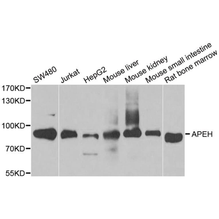 Western blot - APEH antibody from Signalway Antibody (38714) - Antibodies.com