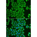 Immunofluorescence - APEH antibody from Signalway Antibody (38714) - Antibodies.com