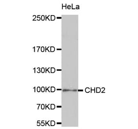 Western blot - CHD2 antibody from Signalway Antibody (38715) - Antibodies.com