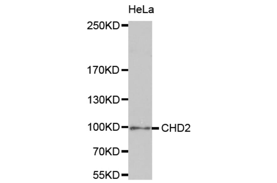 Western blot - CHD2 antibody from Signalway Antibody (38715) - Antibodies.com