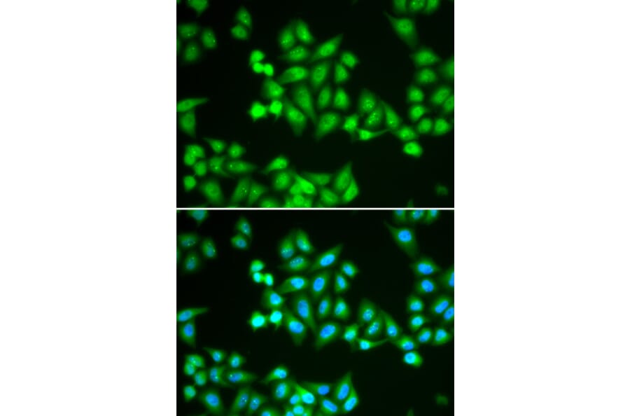 Immunofluorescence - CHD2 antibody from Signalway Antibody (38715) - Antibodies.com
