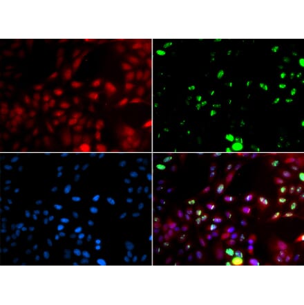 Immunofluorescence - POLK antibody from Signalway Antibody (38720) - Antibodies.com