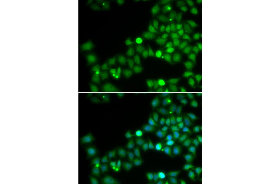 Immunofluorescence - POLK antibody from Signalway Antibody (38720) - Antibodies.com