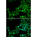 Immunofluorescence - POLK antibody from Signalway Antibody (38720) - Antibodies.com