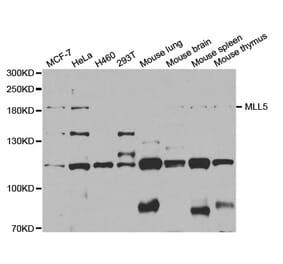 Western blot - MLL5 antibody from Signalway Antibody (38731) - Antibodies.com