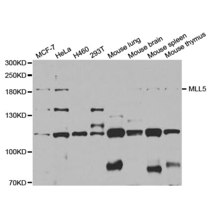 Western blot - MLL5 antibody from Signalway Antibody (38731) - Antibodies.com