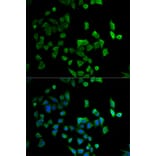 Immunofluorescence - CBX4 antibody from Signalway Antibody (38757) - Antibodies.com