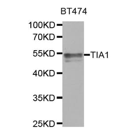 Western blot - TIA1 antibody from Signalway Antibody (38767) - Antibodies.com