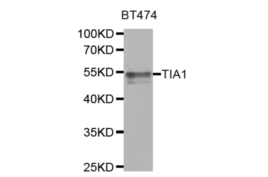 Western blot - TIA1 antibody from Signalway Antibody (38767) - Antibodies.com