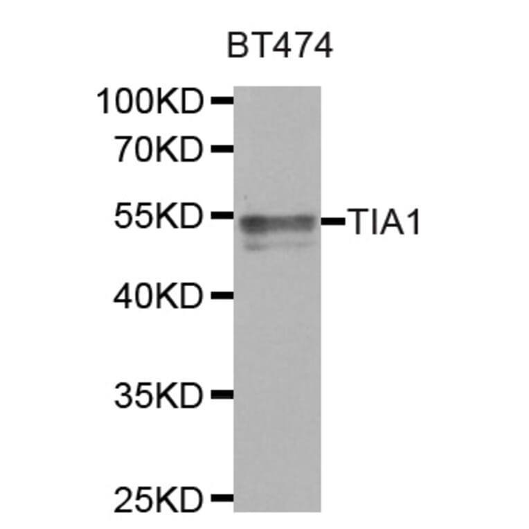 Western blot - TIA1 antibody from Signalway Antibody (38767) - Antibodies.com