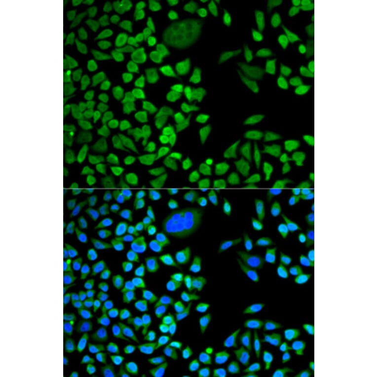 Immunofluorescence - TIA1 antibody from Signalway Antibody (38767) - Antibodies.com