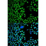 Immunofluorescence - TIA1 antibody from Signalway Antibody (38767) - Antibodies.com