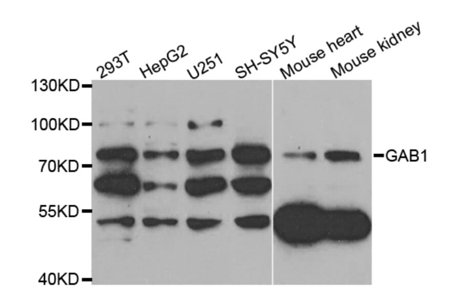 Western blot - GAB1 antibody from Signalway Antibody (38774) - Antibodies.com