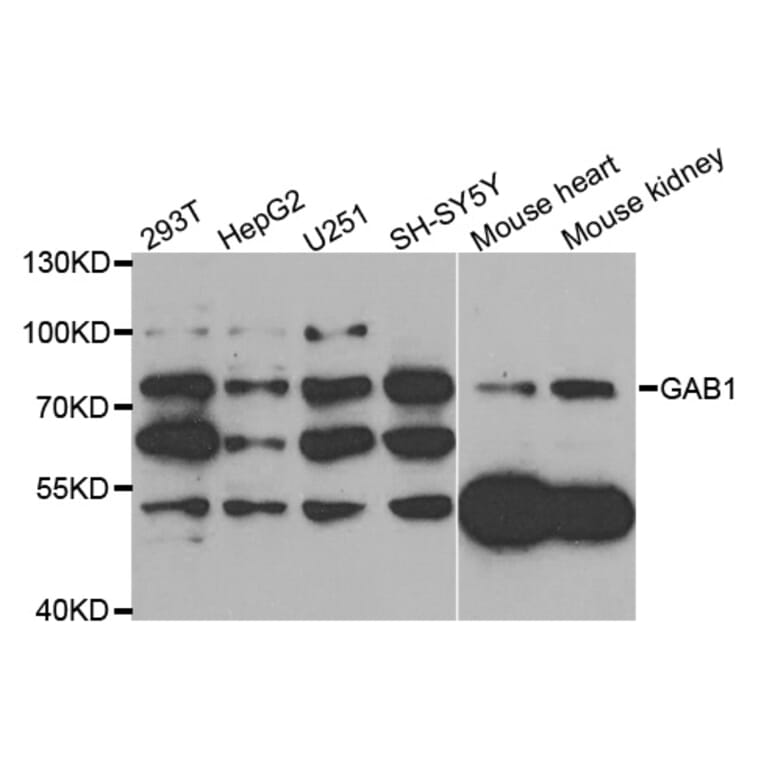 Western blot - GAB1 antibody from Signalway Antibody (38774) - Antibodies.com