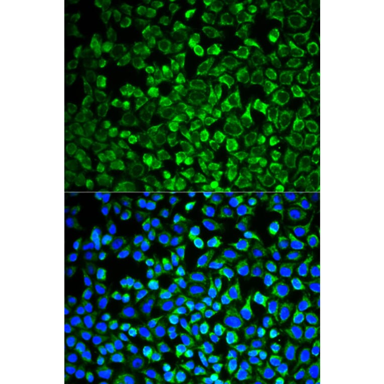 Immunofluorescence - GAB1 antibody from Signalway Antibody (38774) - Antibodies.com