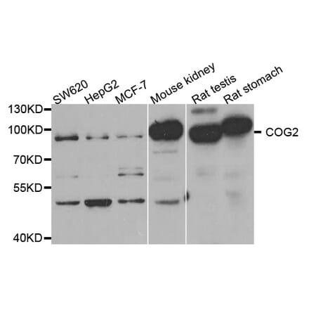 Western blot - COG2 antibody from Signalway Antibody (38777) - Antibodies.com