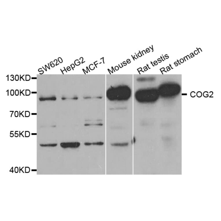 Western blot - COG2 antibody from Signalway Antibody (38777) - Antibodies.com