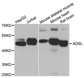 Western blot - ADSL antibody from Signalway Antibody (38788) - Antibodies.com