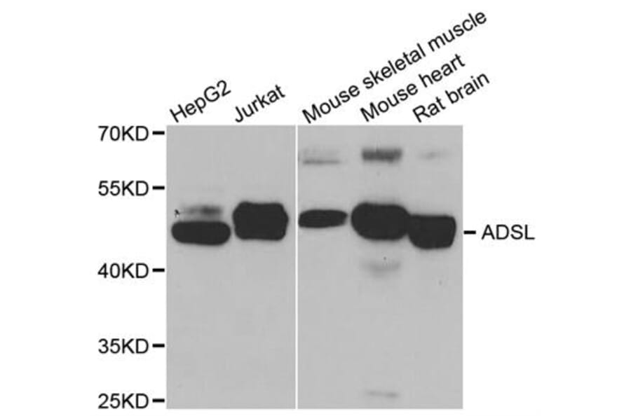 Western blot - ADSL antibody from Signalway Antibody (38788) - Antibodies.com