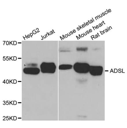 Adenylosuccinate Lyase Antibodies + 