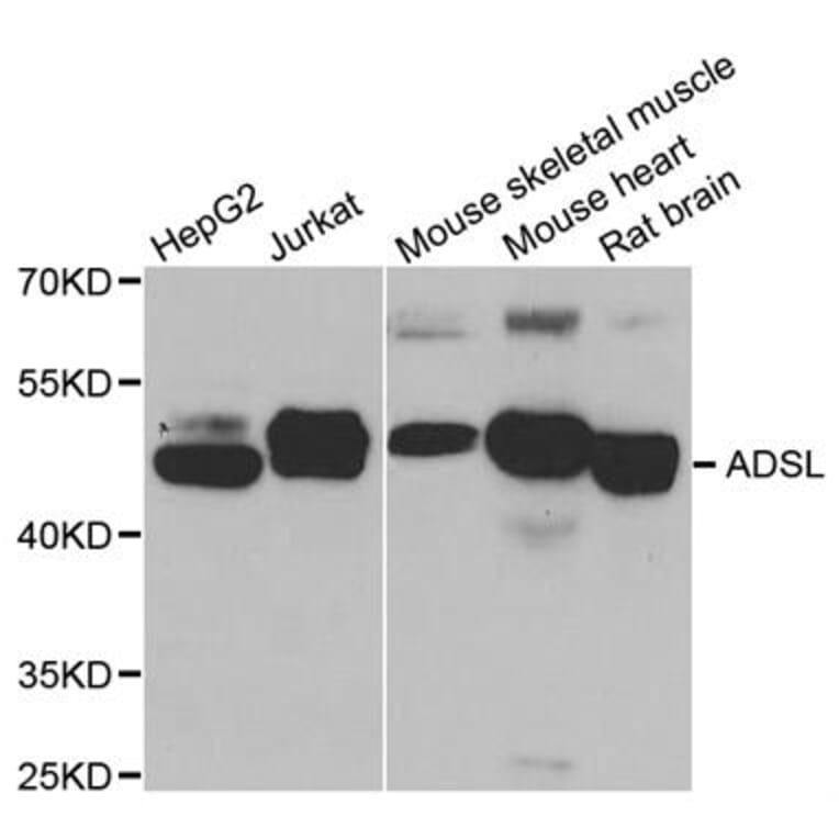 Western blot - ADSL antibody from Signalway Antibody (38788) - Antibodies.com